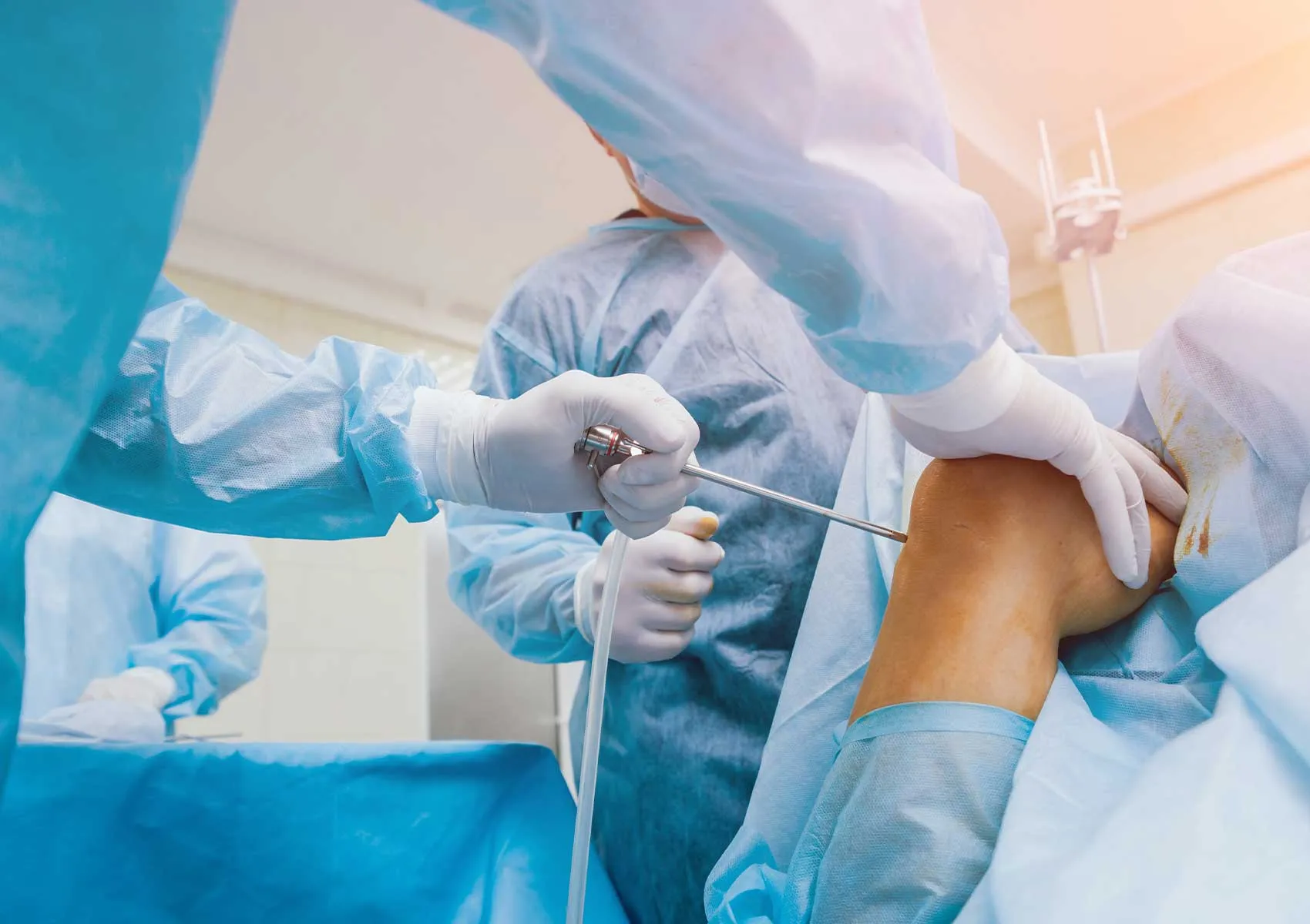 When Is Arthroscopic Surgery Preferred?
