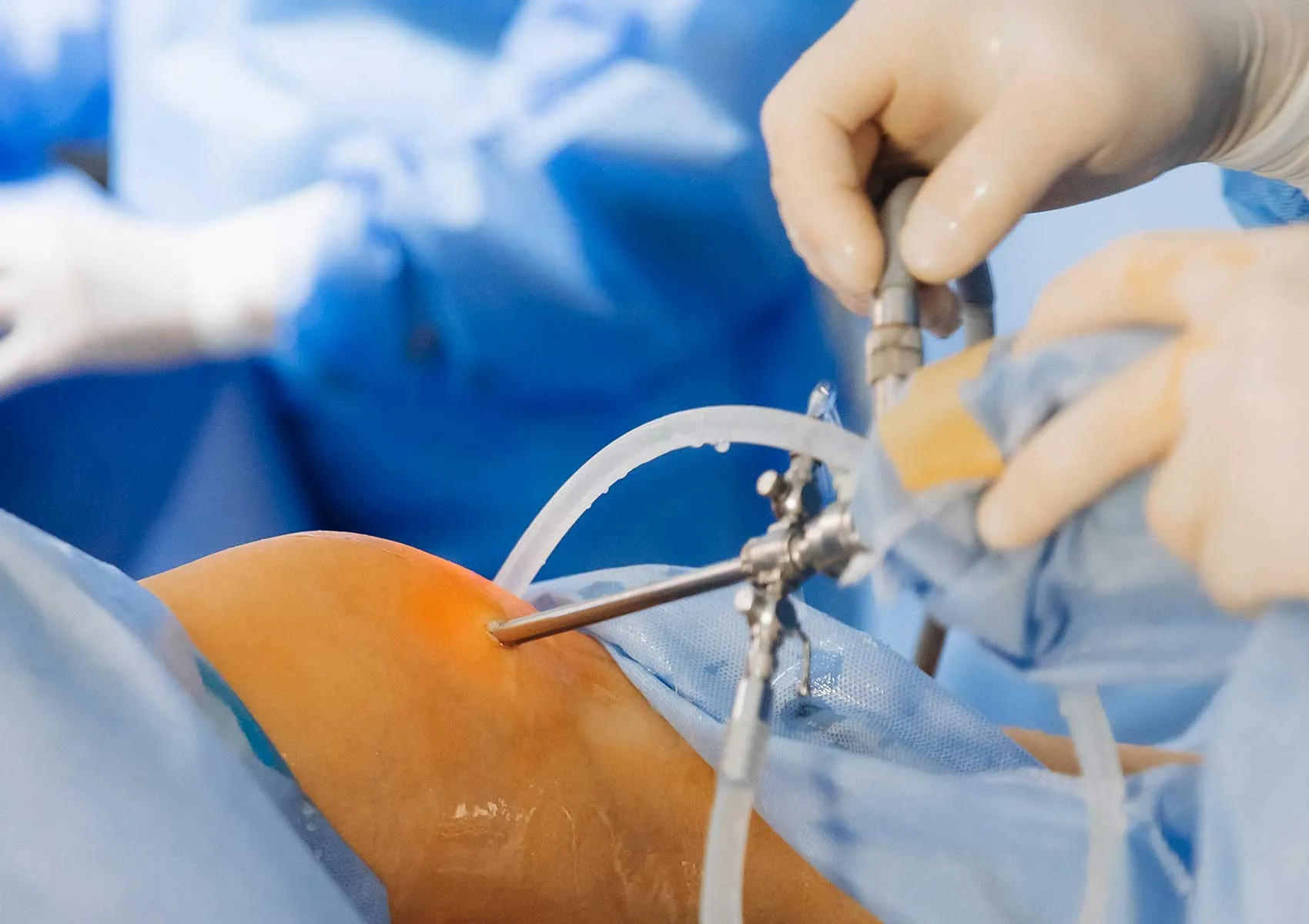 Does Arthroscopic Surgery Cause Pain Afterwards?