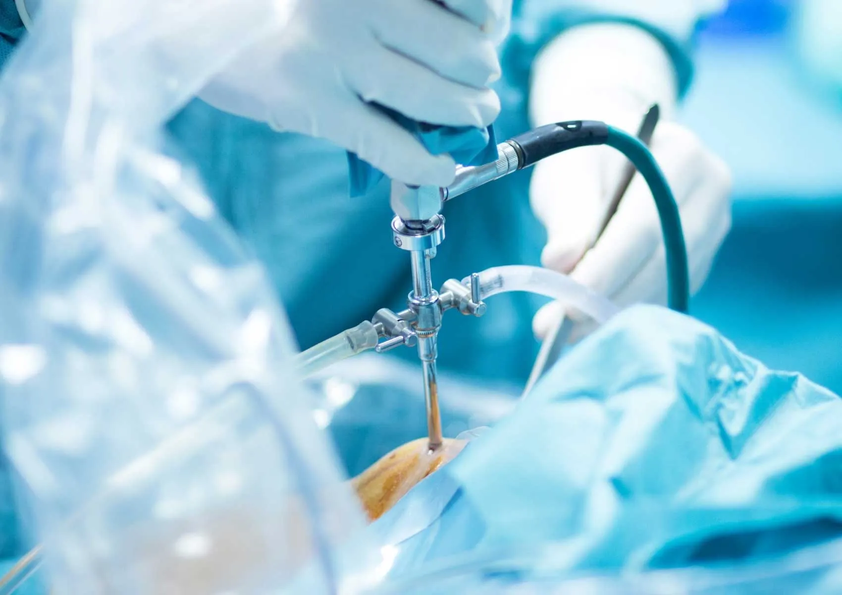 Technological Advances in Arthroscopic Surgeries