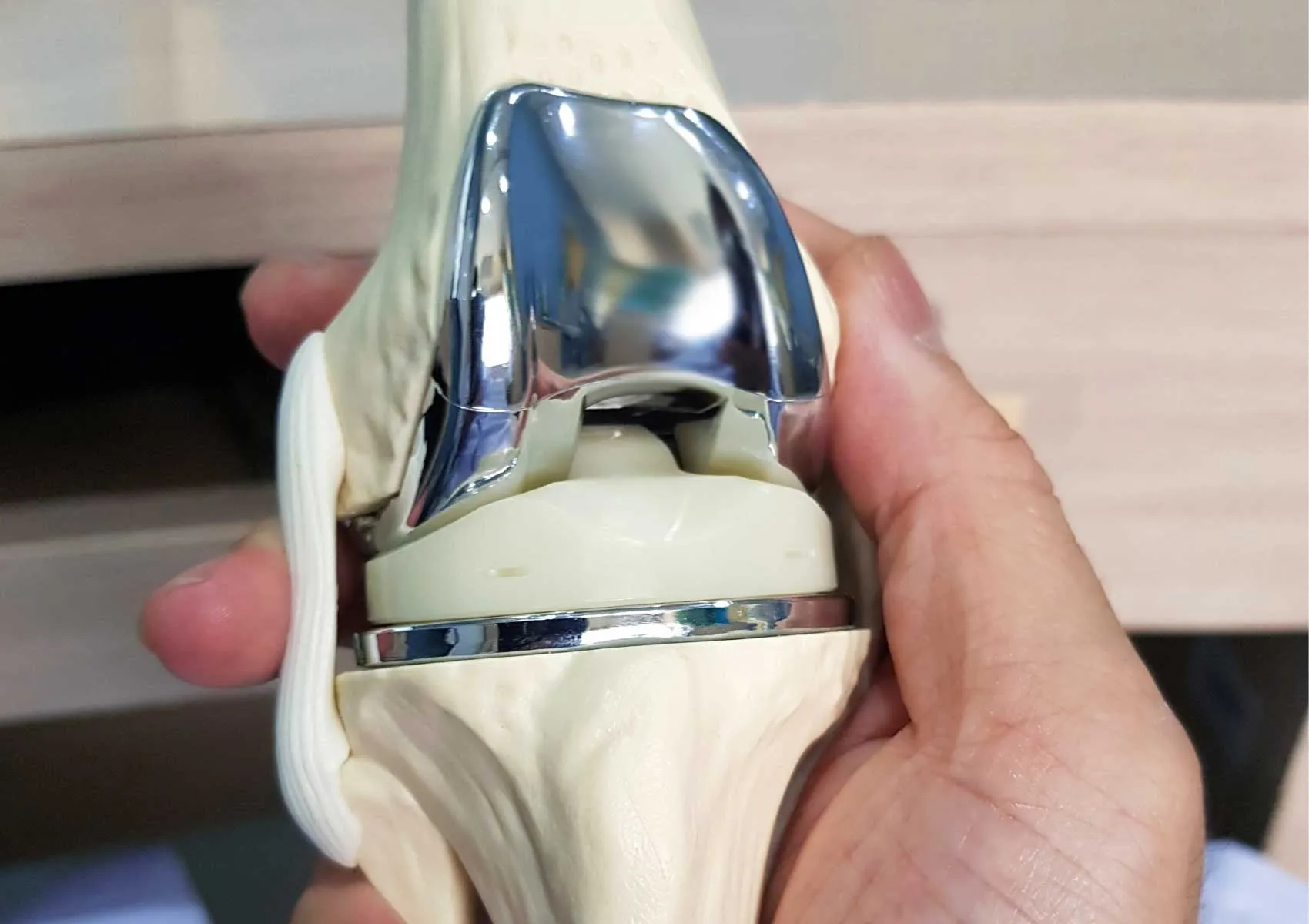 How Long Does Recovery Take After Knee Replacement?