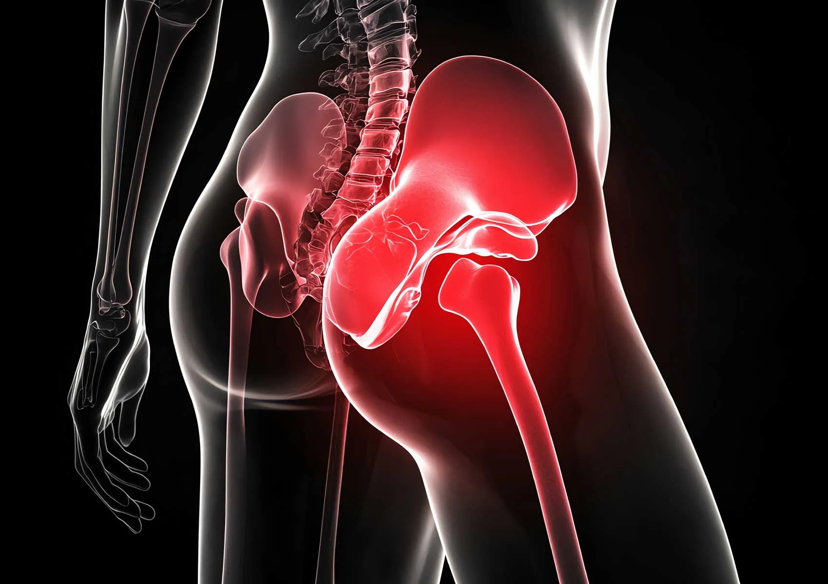 Kalça Ağrısı Nedenleri: Kireçlenme mi, Sıkışma mı?