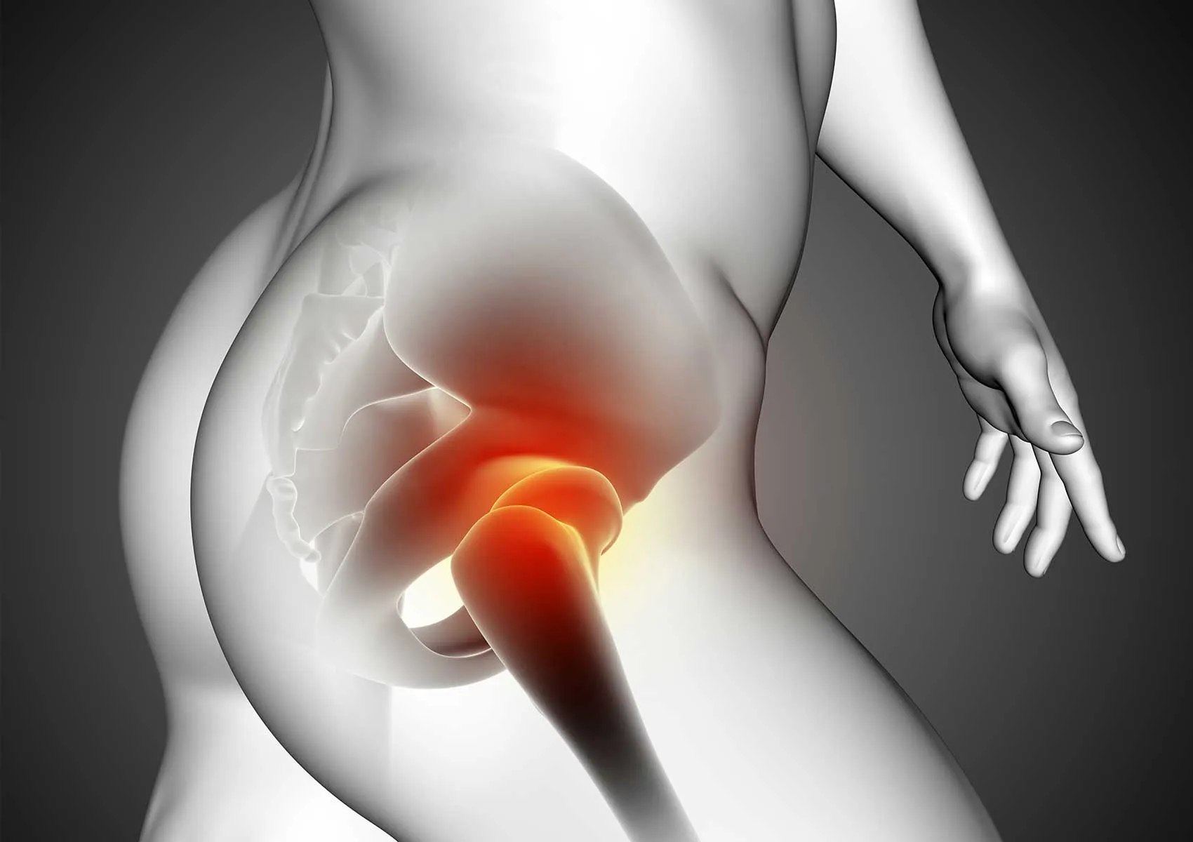 Hip Arthroscopy: Procedure, Risks, and Recovery Guide