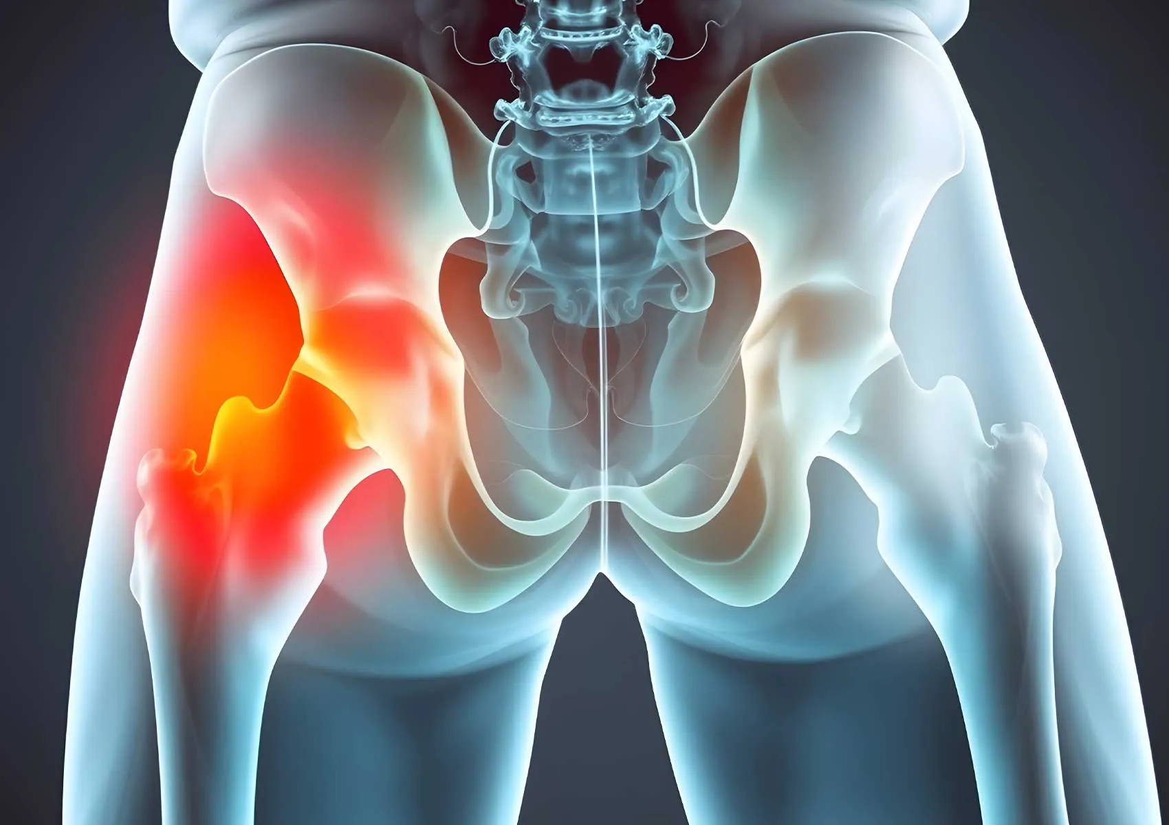 Hip Labrum Tear: Symptoms, Diagnosis, and Treatment Options