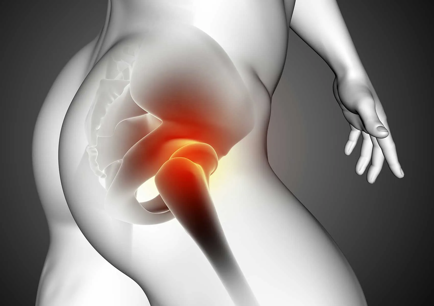 Kalça Labrum Yırtığı: Belirtileri, Tanı ve Tedavisi