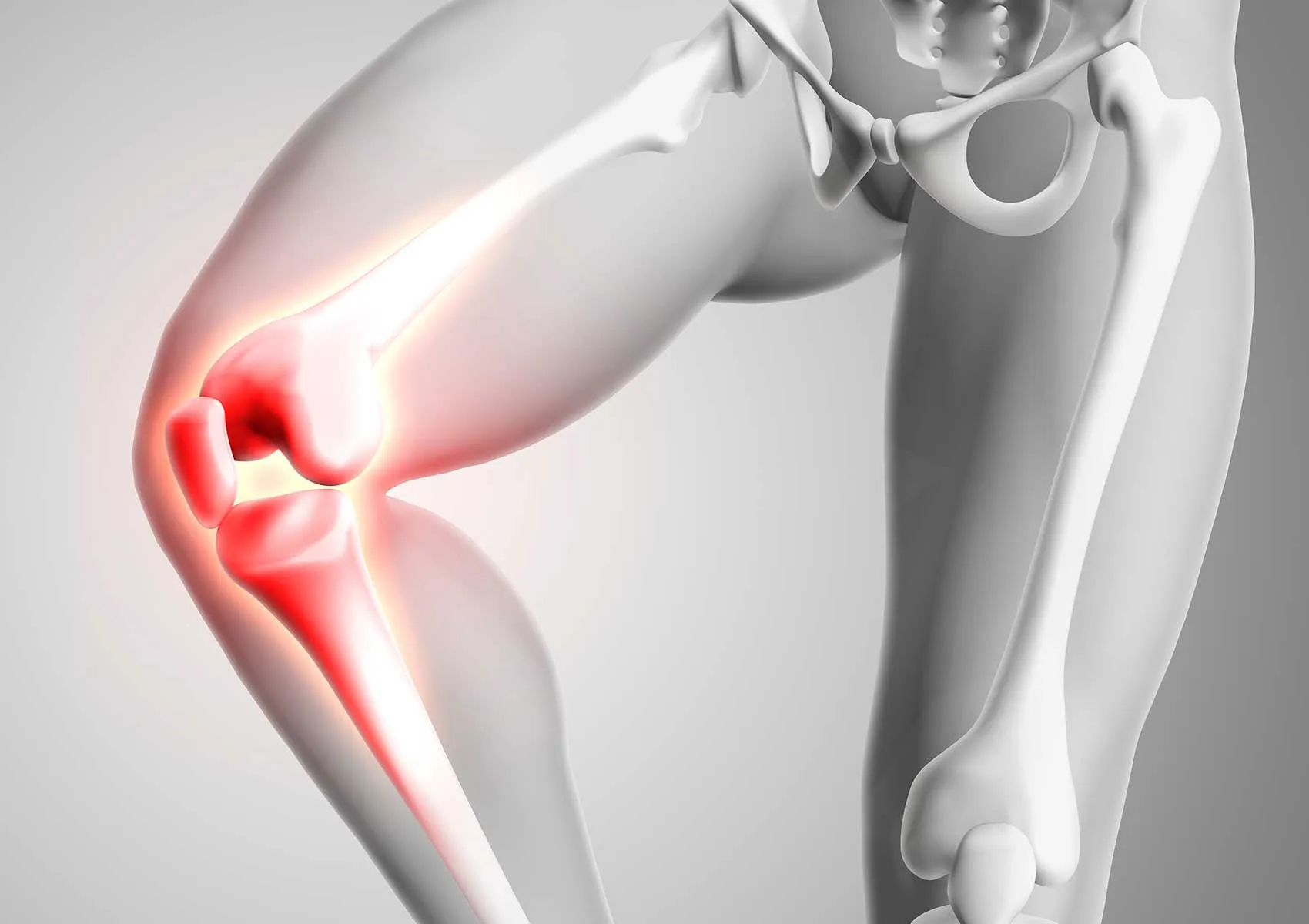 What Is a Meniscus Tear? What Are the Symptoms?