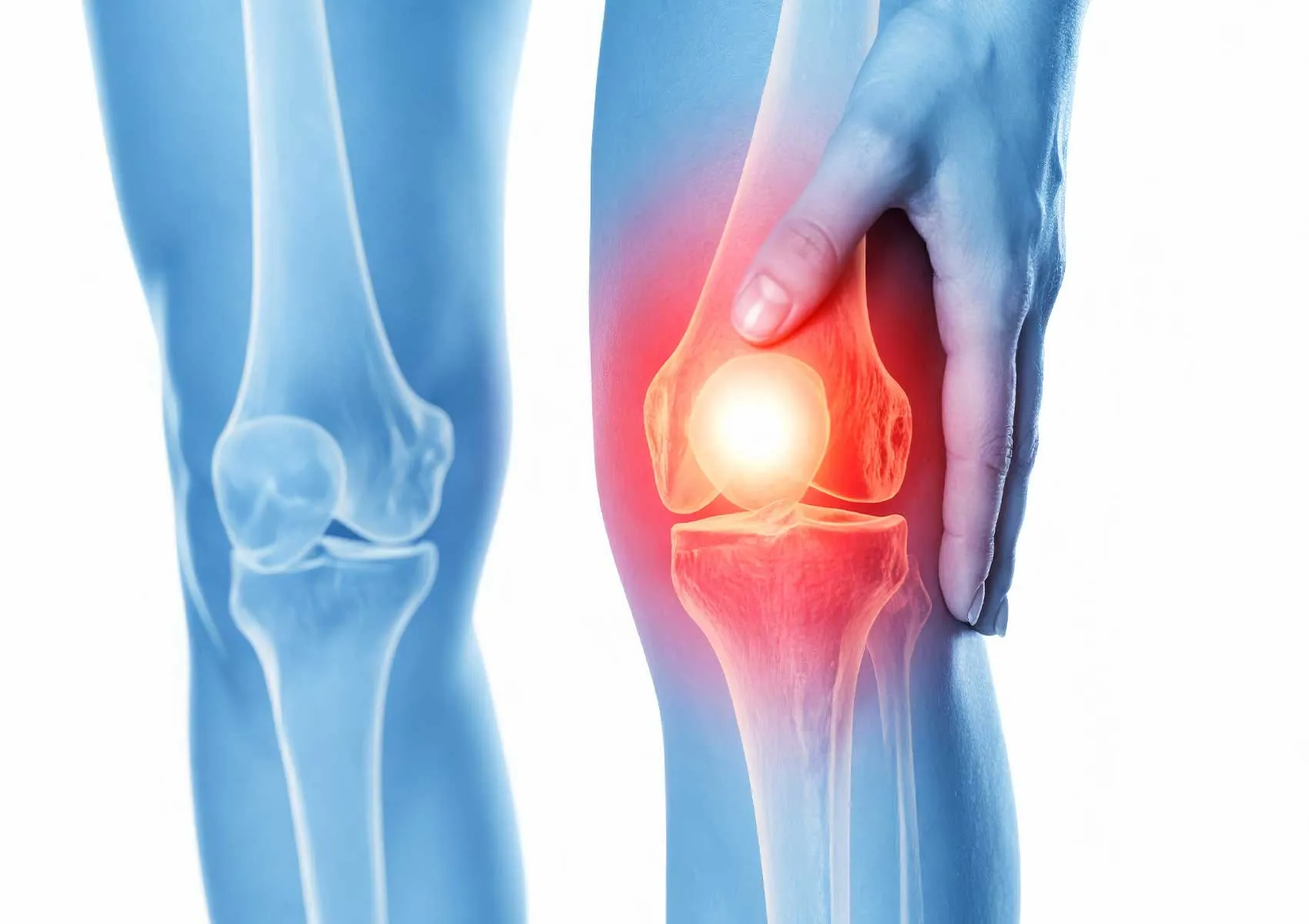 Menisküs Yırtığı Tedavisi: Ameliyat ve Cerrahi Süreçler