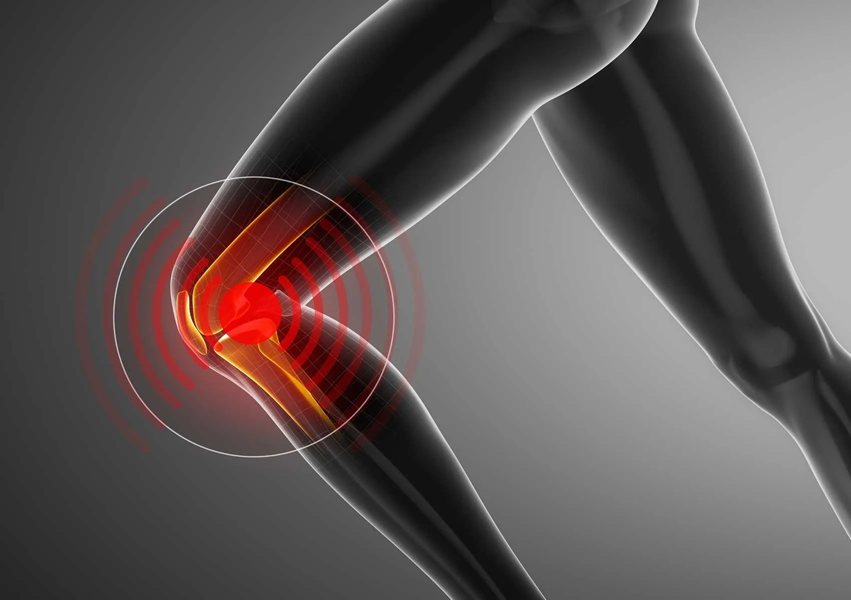 Meniscus Tear Treatment: Repair vs. Removal Compared