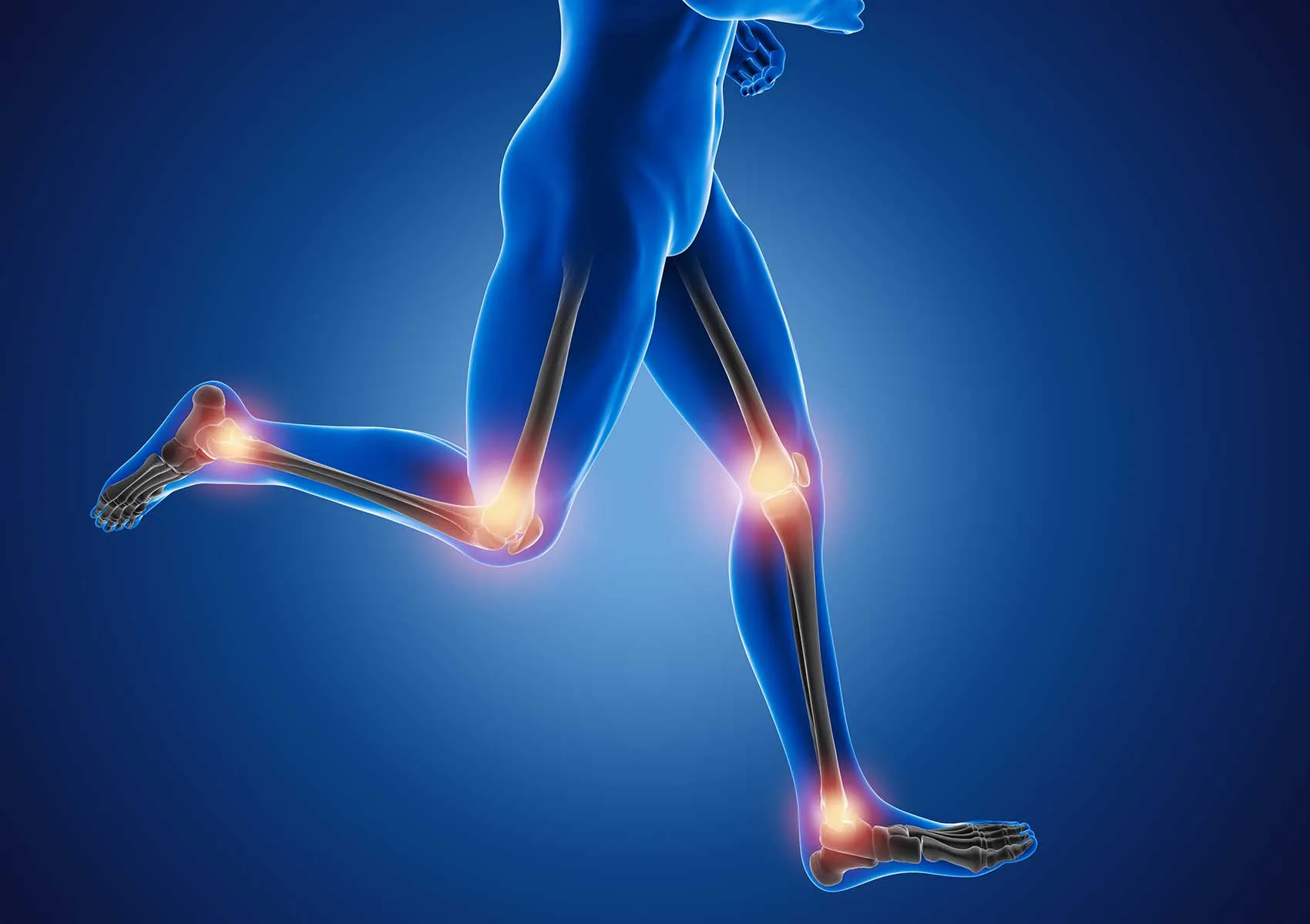 How Does Life Change After an Osteotomy?