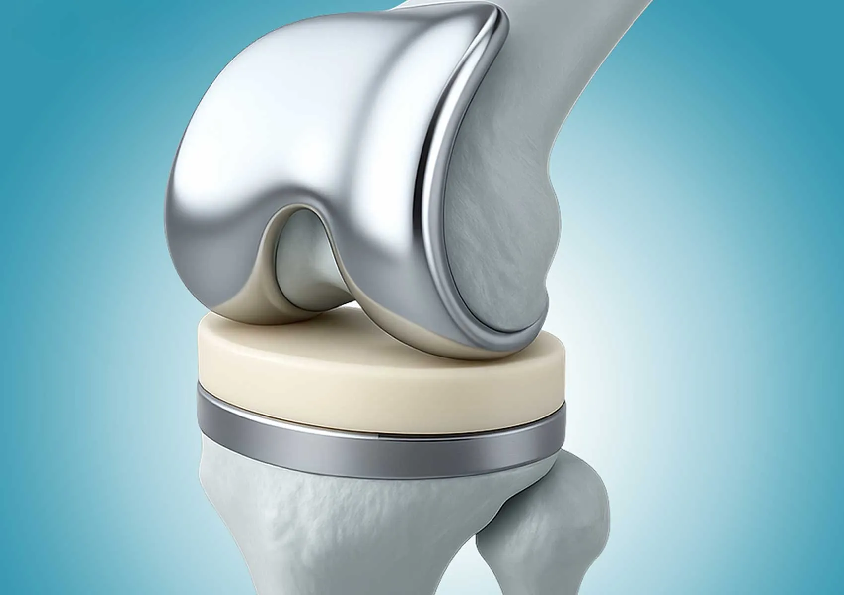 Protez Cerrahisine Alternatif Tedavi Yöntemleri