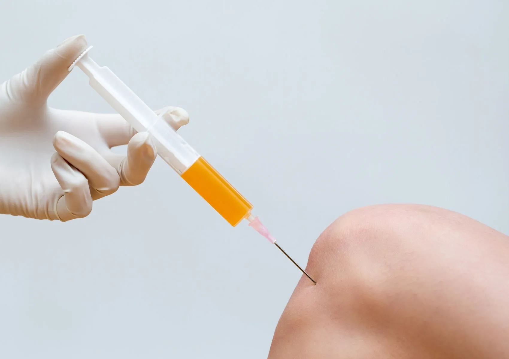 Differences Between PRP and Stem Cell Therapy