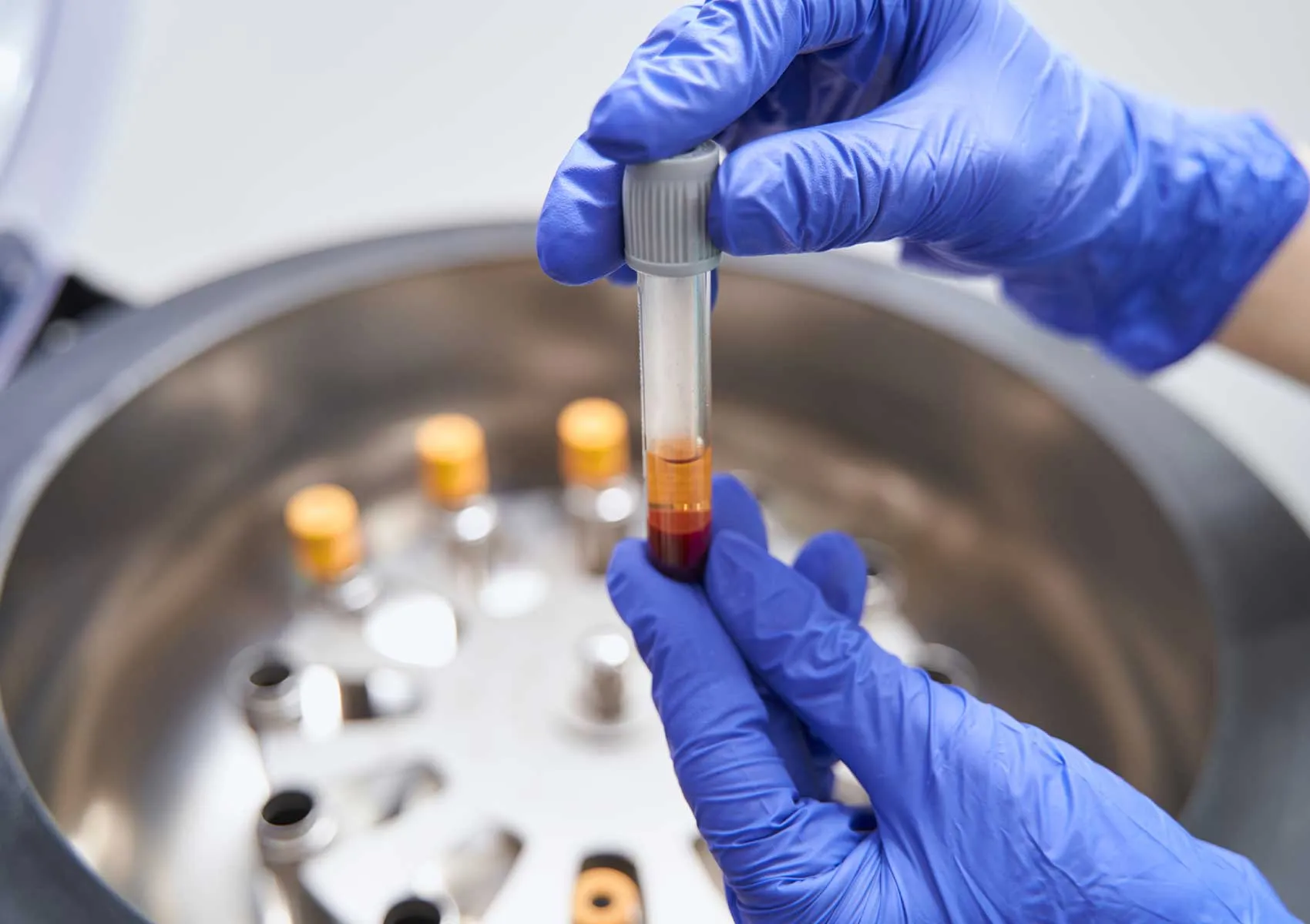 What Is the Scientific Basis of PRP?
