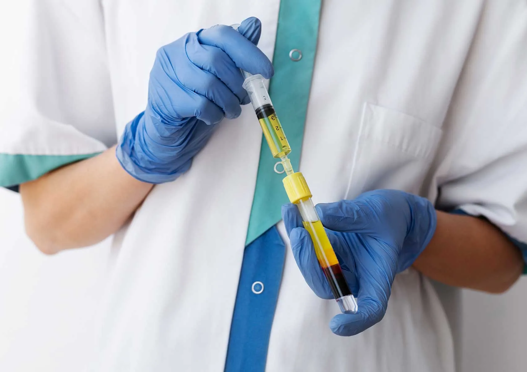 PRP Tedavisi Ne Kadar Sürede Etki Gösterir?