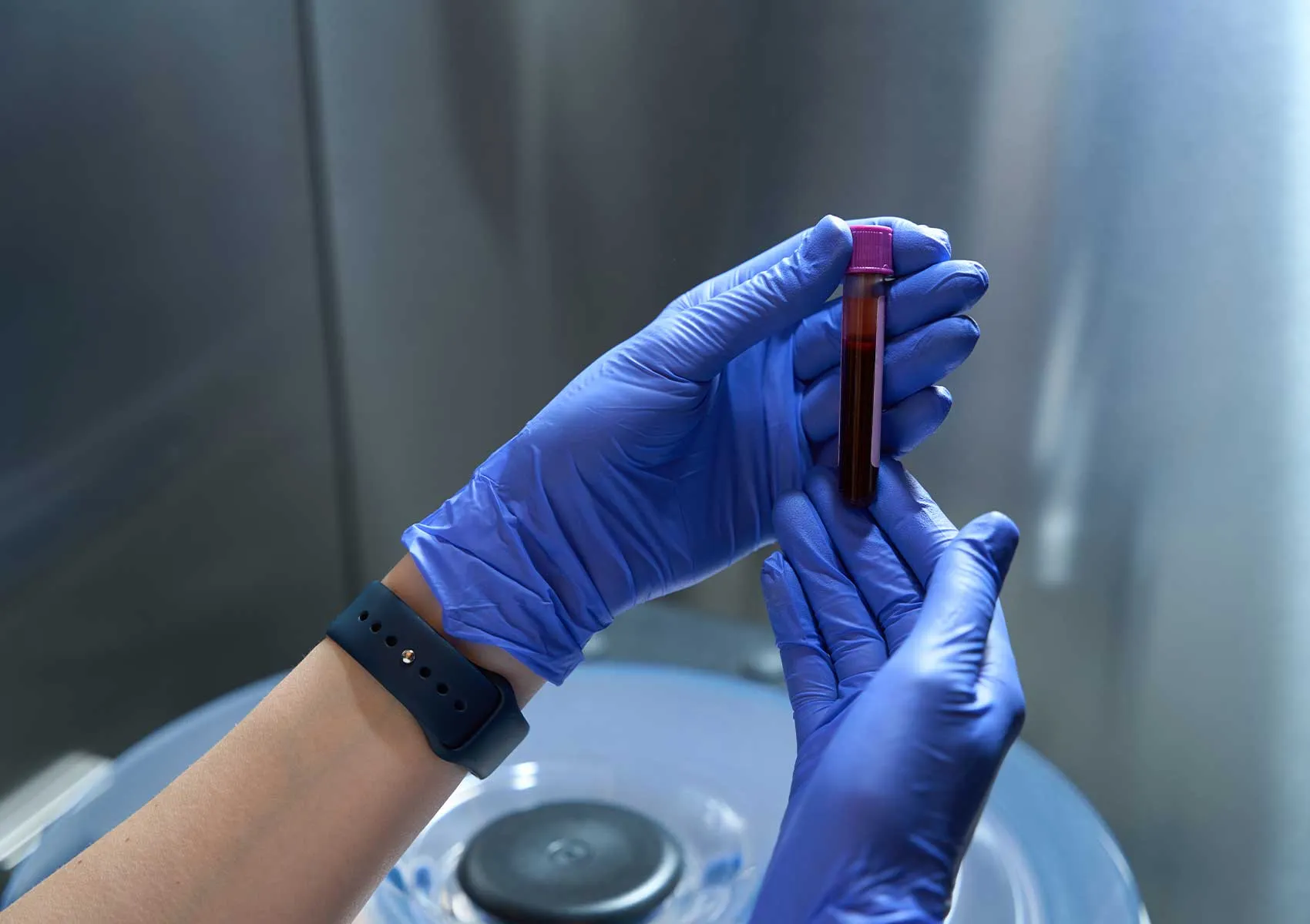 Is PRP Treatment Available in Public Hospitals?
