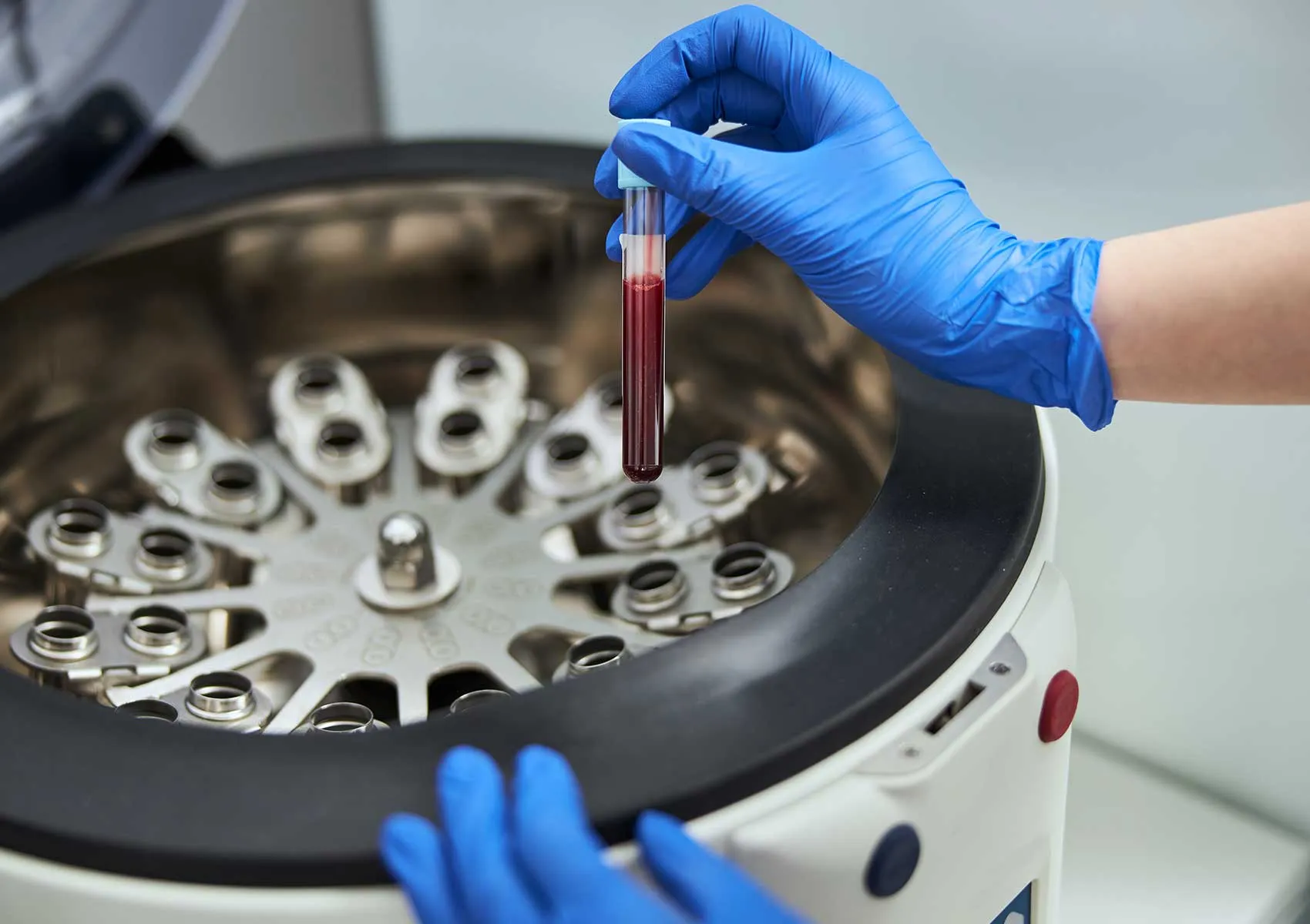 Use of PRP in Tendon and Ligament Injuries