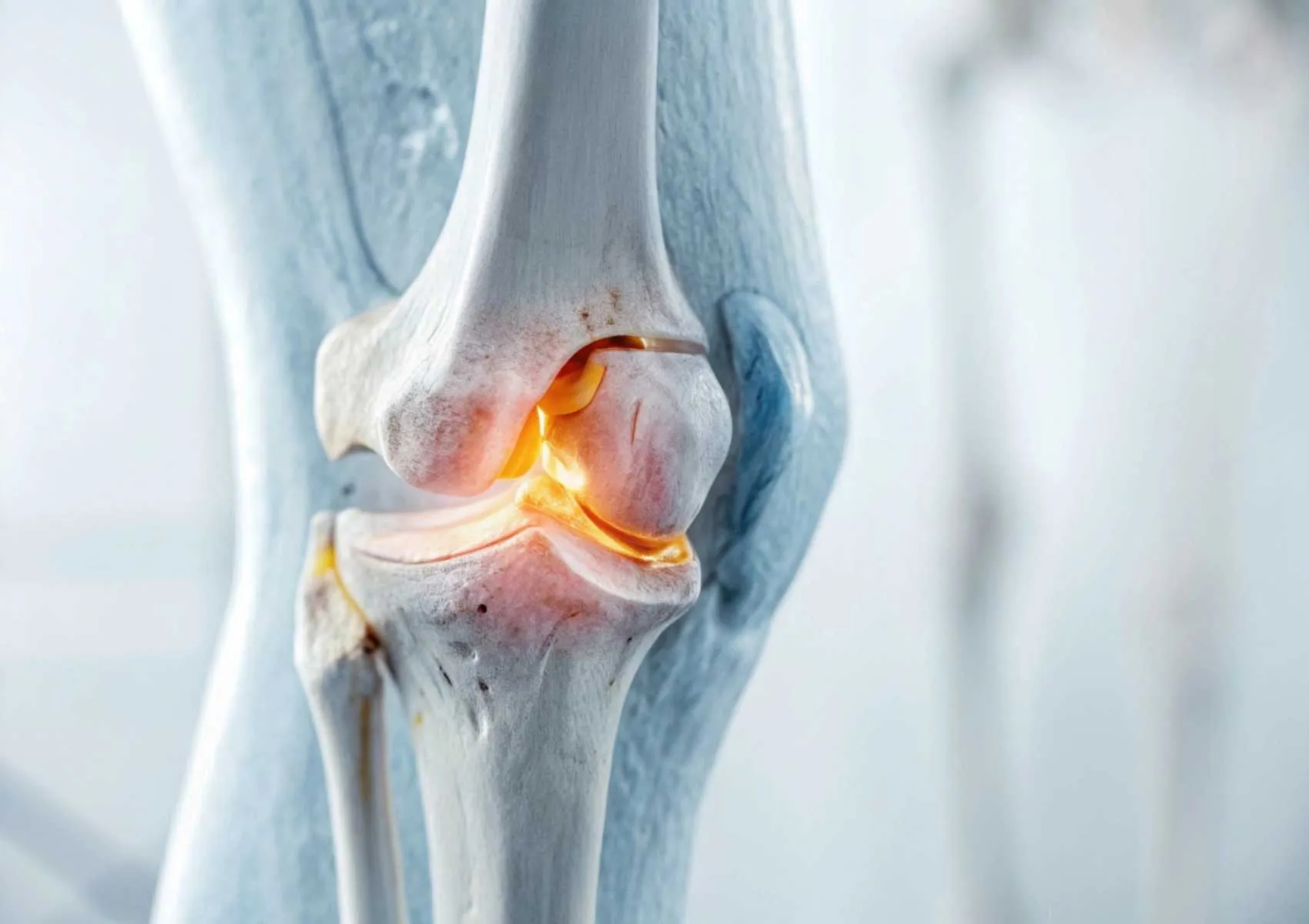 What is Unicondylar Knee Replacement (Partial Knee Replacement)?