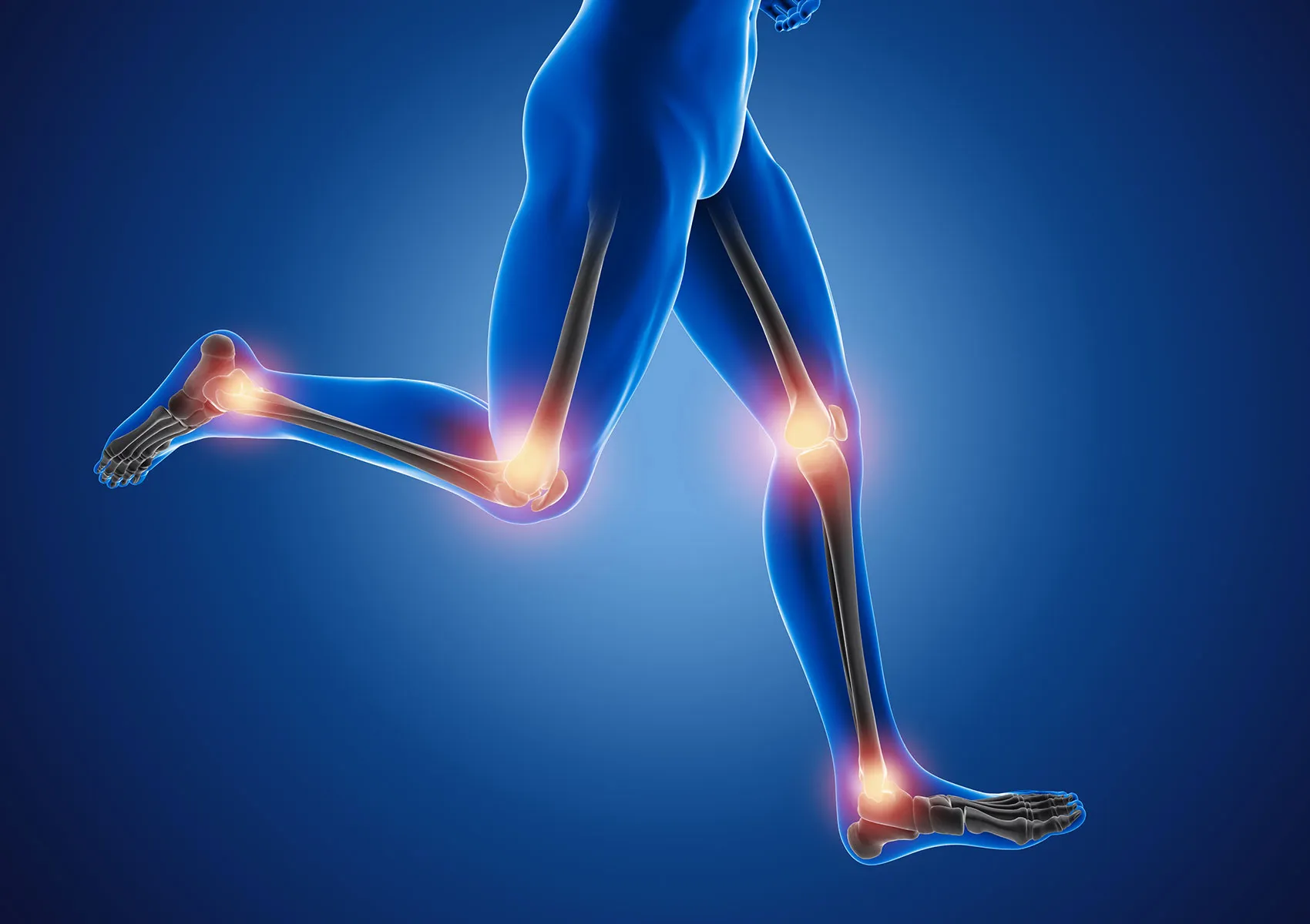 Yüksek Tibia Osteotomisi Nedir?